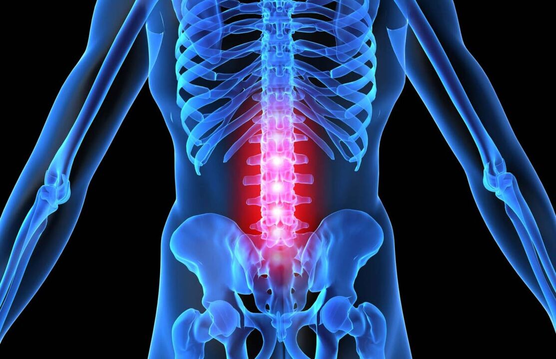 Melegítő kenőcsök a mellkasi gerinc osteokondrozisához A gyakori osteochondrosis jelei és tünetei